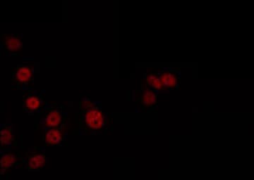 Polyclonal Rabbit anti-Human MED24 / TRAP100 Antibody (IF, WB)