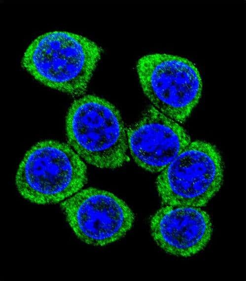 Polyclonal Rabbit anti-Human XKR4 Antibody (aa570-598, IHC, IF, WB)