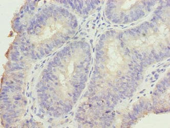 Polyclonal Rabbit anti-Human DDI2 Antibody (IHC, WB)