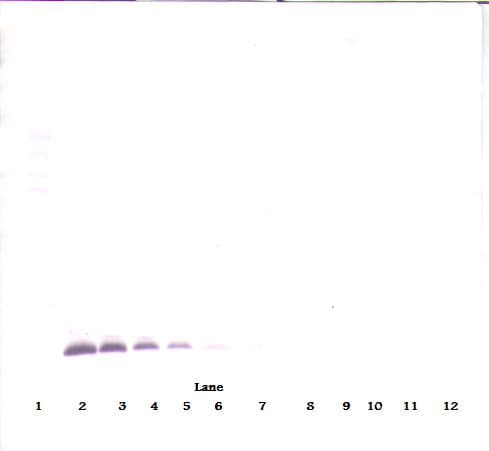 IHC-plus™ Polyclonal Rabbit anti-Human TIMP1 Antibody (aa24-207, IHC, WB)
