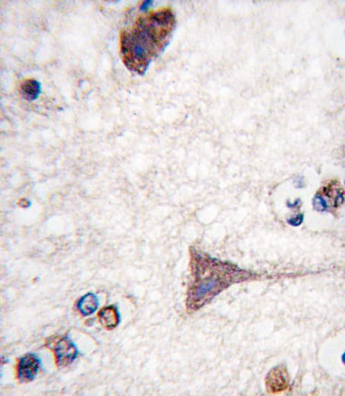 BRAF / B-Raf Antibody (Thr400)