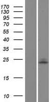 UBE2E1 / UBCH6 Protein (Over-Expression Lysate Myc-DDK (Flag))