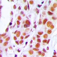 RB1 / Retinoblastoma / RB Antibody (C-Terminus)
