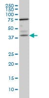 Monoclonal Mouse anti-Human PNMA1 / MA1 Antibody (clone 4G6, IHC, WB)