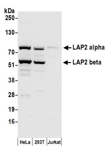 TMPO / TP / Thymopoietin Antibody (aa1-50)