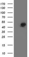 SMS / Spermine Synthase Antibody (clone OTI 1A7)