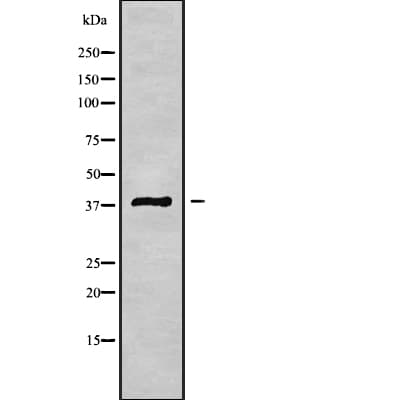 Polyclonal Rabbit anti-Human MAGEB3 Antibody (WB)