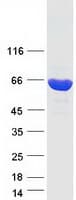 Human TKT / Transketolase Protein (Recombinant Myc-DDK (Flag))