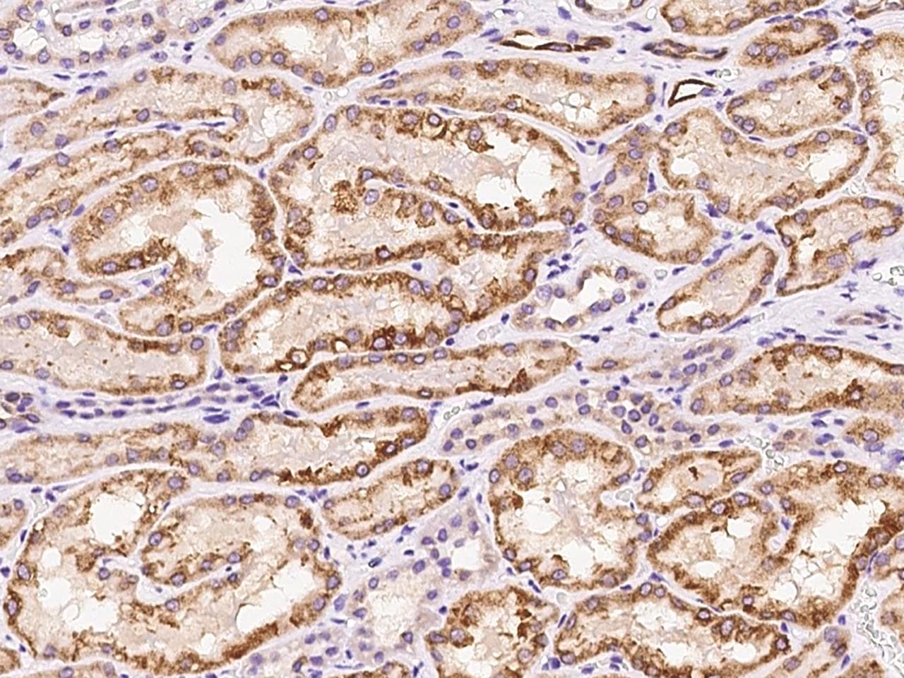 UGT1A6 Antibody