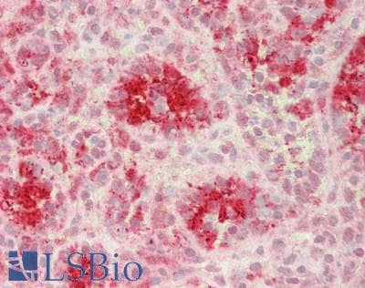 IHC-plus™ FTL / Ferritin Light Chain Antibody (aa 2-175)