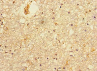 Polyclonal Rabbit anti-Human PRMT3 Antibody (IHC, IF, WB)