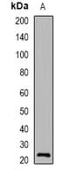 VILIP / VSNL1 Antibody