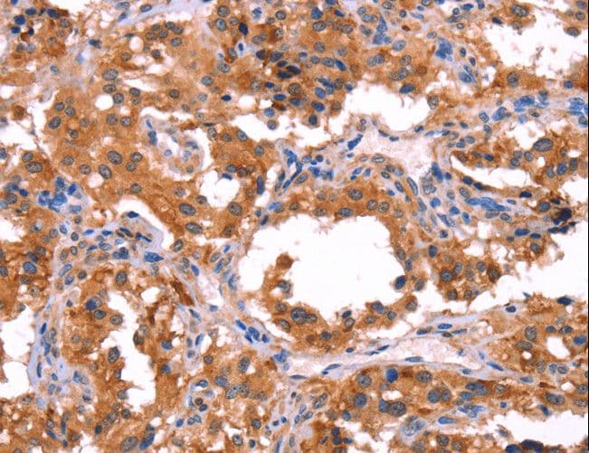 ERAS Antibody