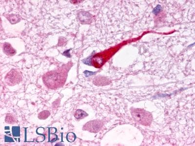 PathPlus™ GALR1 / Galanin Receptor 1 Antibody (Extracellular Domain)