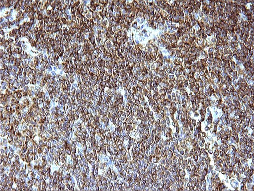 Monoclonal Mouse anti-Human SCAMP2 Antibody (clone OTI1H10, IHC, WB)