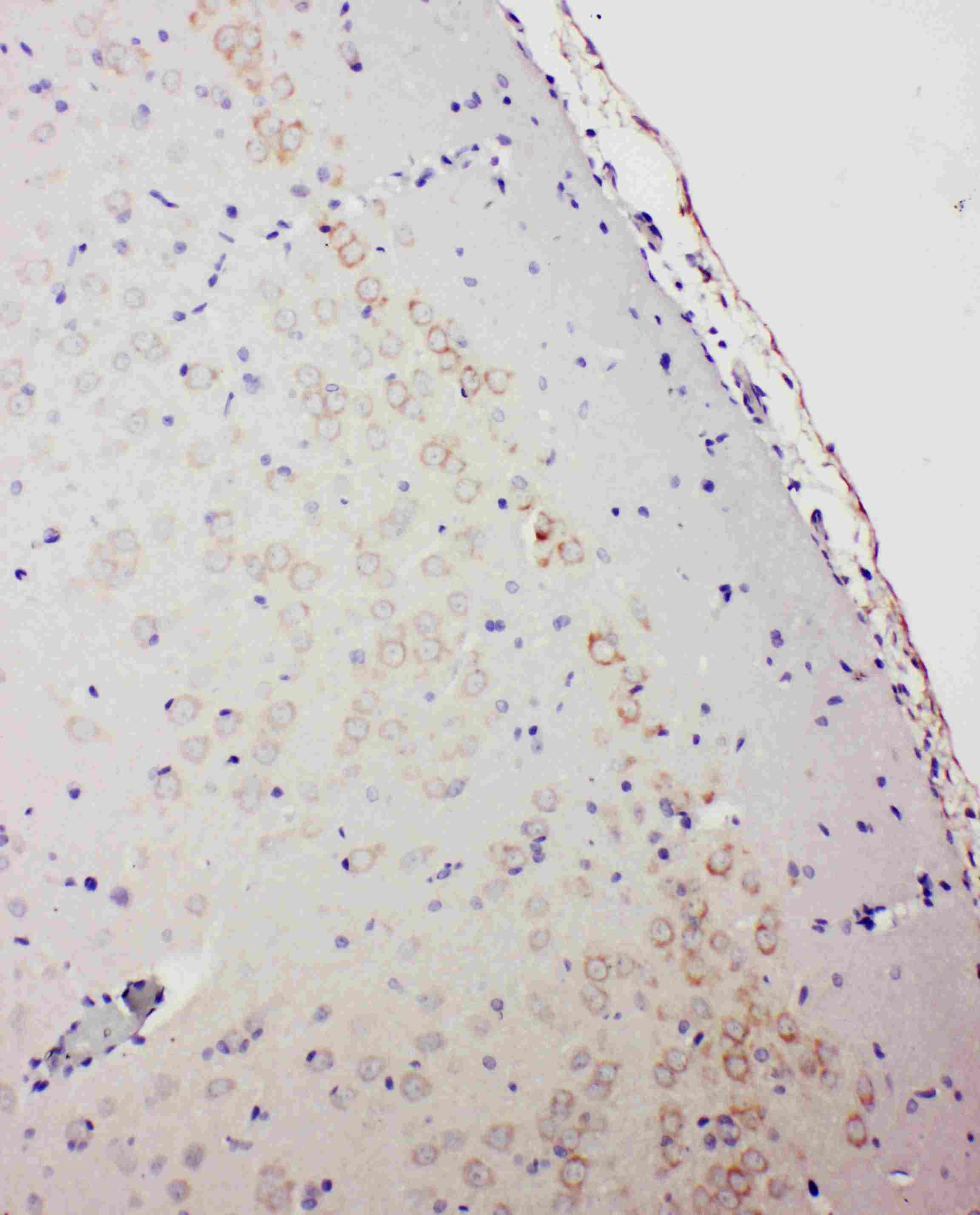 Polyclonal Rabbit anti-Human GABRA1 Antibody (aa440-456, IHC, WB)