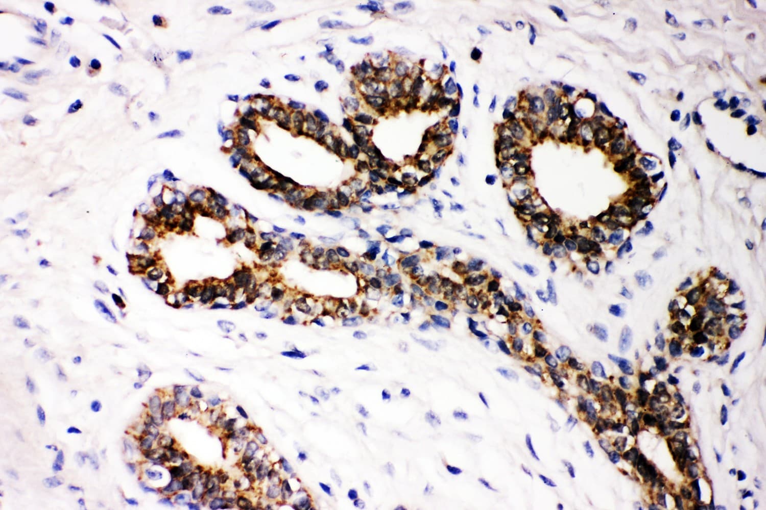Polyclonal Rabbit anti-Human FHIT Antibody (aa1-147, IHC, WB)