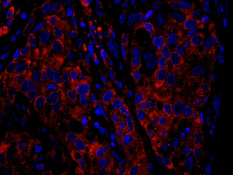 IHC-plus™ Polyclonal Rabbit anti-Human RPS6 / Ribosomal Protein S6 Antibody (aa200-C-term, IHC, IF)