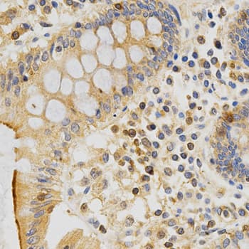 PRKCE / PKC-Epsilon Antibody