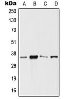SIX3 Antibody (Internal)