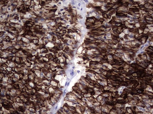 Monoclonal Mouse anti-Human KRT19 / CK19 / Cytokeratin 19 Antibody (clone OTI9A9, aa240-390, IHC)