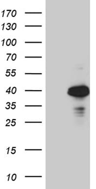 OTC Antibody (aa33-354, clone OTI8H9)