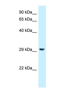 RPS4X + RPS4Y1 + RPS Antibody (aa189-238)