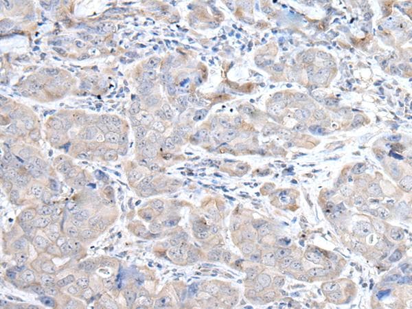 RASA1 Antibody
