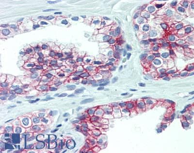 IHC-plus™ Polyclonal Rabbit anti-Human DSG1 / Desmoglein 1 Antibody (IHC, WB)