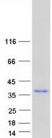 Human TXNDC5 / ERP46 Protein (Recombinant Myc-DDK (Flag))