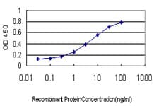 IHC-plus™ BUB1B / BubR1 Antibody (clone 3F2)