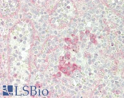 IHC-plus™ Polyclonal Rabbit anti-Human HK3 / Hexokinase 3 Antibody (aa799-848, IHC, WB)