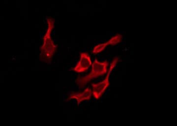 OR51B2 Antibody