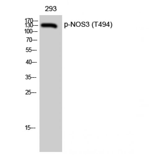 Polyclonal Rabbit anti-Human NOS3 / eNOS Antibody (430-510 aa, WB)