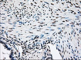 BRAF / B-Raf Antibody (clone OTI3B12)