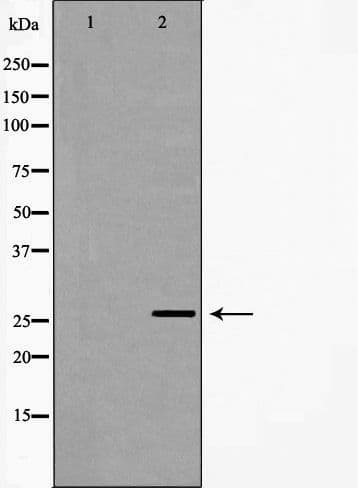 NQO2 Antibody