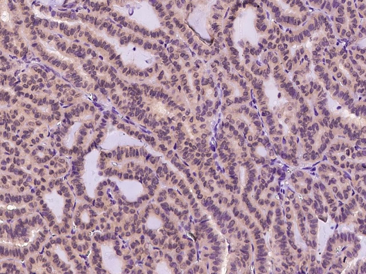 TRP32 / TXNL1 Antibody