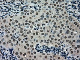 SCYL3 Antibody (clone OTI1A5)