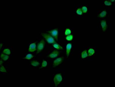 Polyclonal Rabbit anti-Human MTMR12 Antibody (IF)