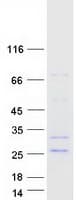Human FGF21 Protein (Recombinant Myc-DDK (Flag))