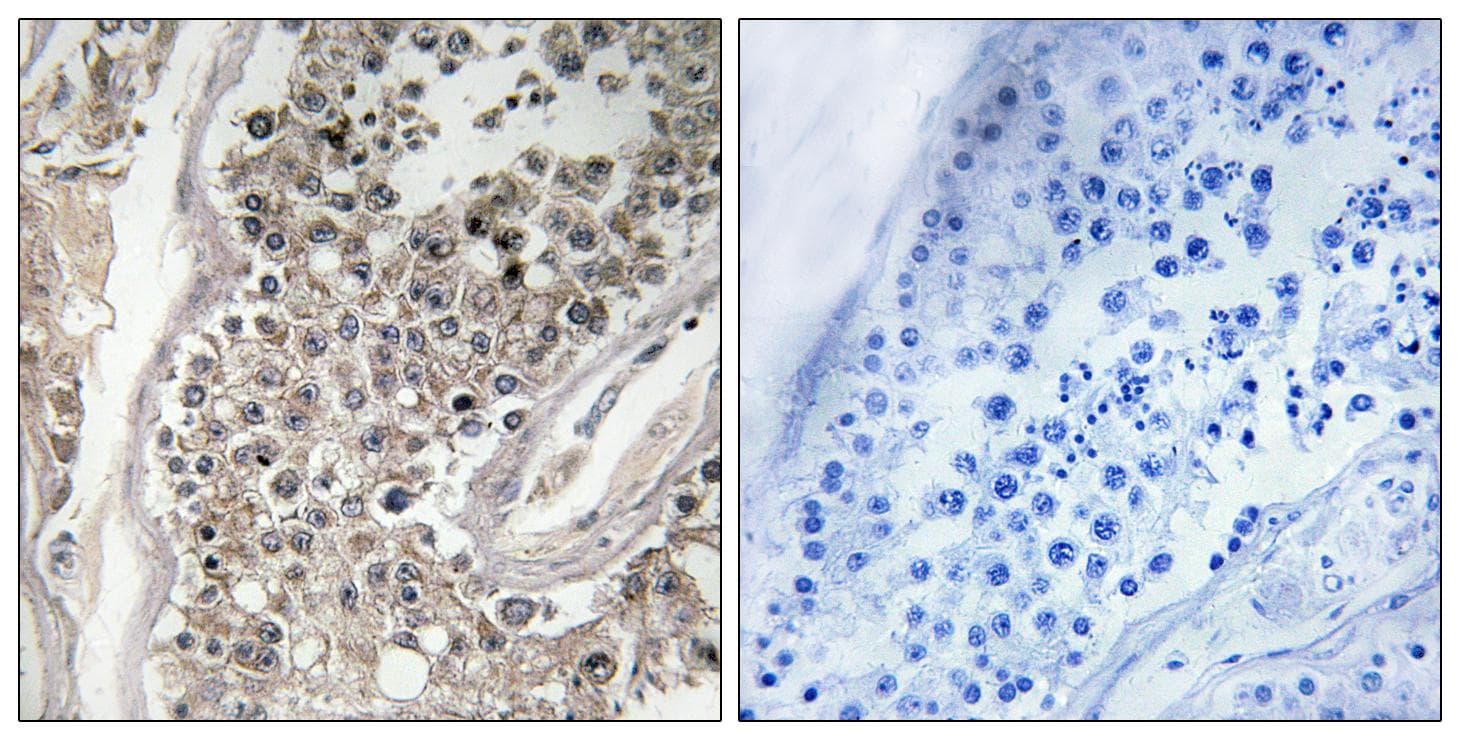 RAB3GAP1 Antibody