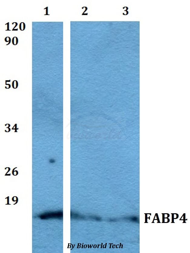 FABP4 / AP2 Antibody