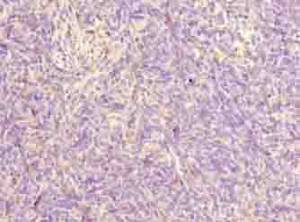 FAM124A Antibody