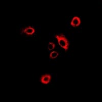 GARS / Glycyl tRNA Synthetase Antibody