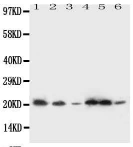 Polyclonal Rabbit anti-Human SSR3 / TRAP-Gamma Antibody (aa8-23, IHC, WB)