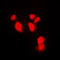 CHEK1 / CHK1 Antibody (Internal)