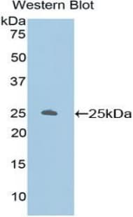 PRKCZ / PKC-Zeta Antibody (aa404-591, HRP)