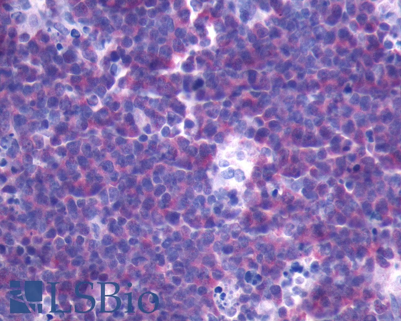 IHC-plus™ FPR3 / FPRL2 Antibody (N-Terminus)
