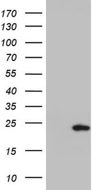 PTGES3 / p23 Antibody (clone OTI4D11)