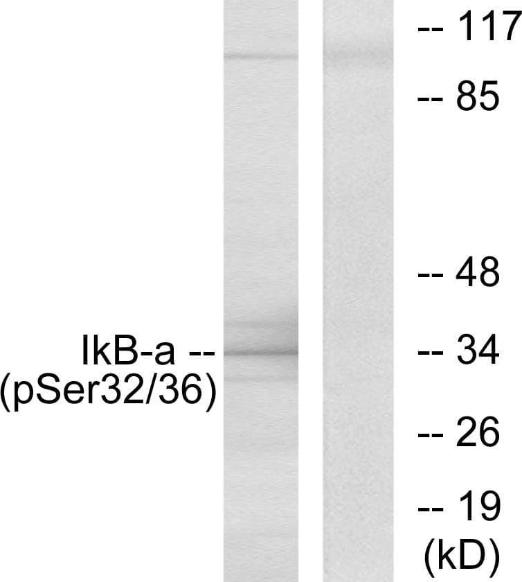 NFKBIA / IKB Alpha / IKBA Antibody (phospho-Ser32/Ser36)